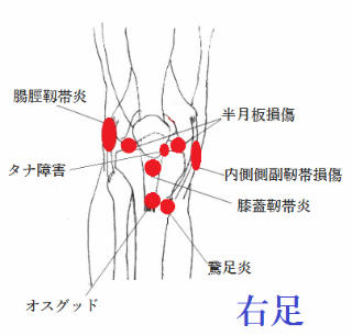 膝の痛み