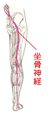 坐骨神経痛