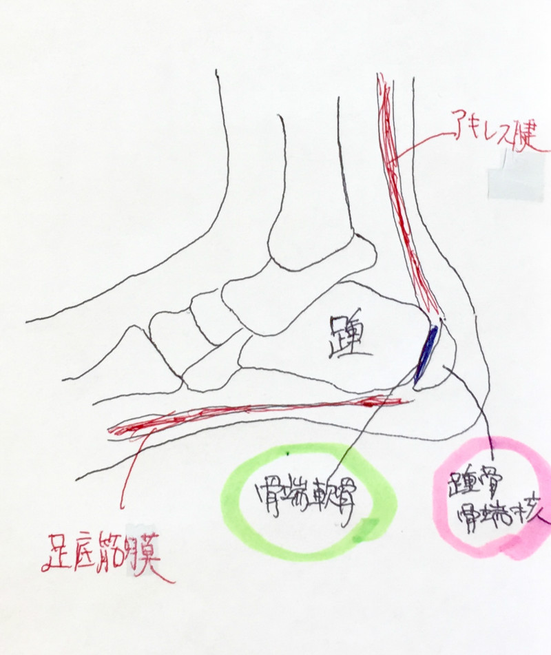 かかとの痛み